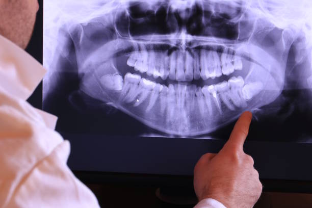 Best Mobile Emergency Dentist in Mill City, OR