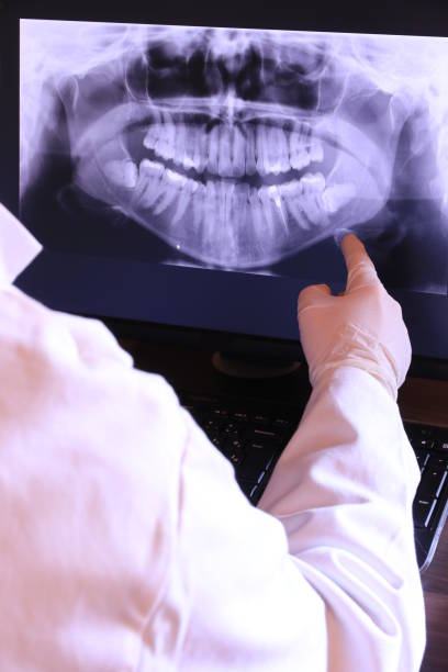 Best Emergency Dentist for Special Needs Patients in Mill City, OR